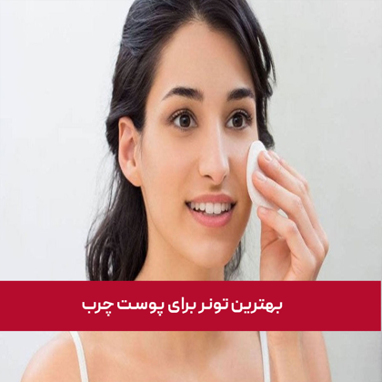 معرفی "بهترین تونر برای پوست چرب" در سال 1404